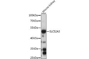 Western blot analysis of extracts of mouse kidney, using SLC52 antibody (ABIN7270472) at 1:1000 dilution. (Solute Carrier Family 52 (Riboflavin Transporter), Member 3 (SLC52A3) (AA 200-300) Antikörper)