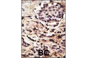 Immunohistochemistry (Paraffin-embedded Sections) (IHC (p)) image for anti-Beclin 1, Autophagy Related (BECN1) (AA 210-239) antibody (ABIN388546)