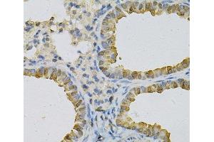 Immunohistochemistry (Paraffin-embedded Sections) (IHC (p)) image for anti-Cytidine Deaminase (CDA) antibody (ABIN7257523)