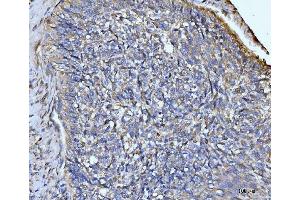 IHC analysis of GLUL using anti-GLUL antibody (ABIN7602403). (GLUL Antikörper  (AA 74-373))