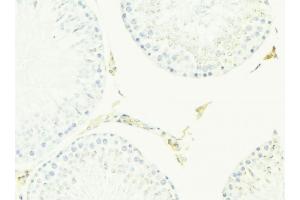 ABIN6276968 at 1/100 staining Mouse testis tissue by IHC-P. (ACPP Antikörper  (Internal Region))