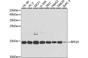 Western blot analysis of extracts of various cell lines, using RPS19 antibody (ABIN1874653) at 1:1000 dilution. (RPS19 Antikörper)