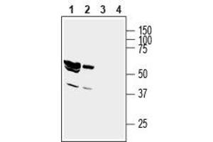 Western blot analysis of rat brain lysate (lanes 1 and 3) and mouse brain membranes (lanes 2 and 4): - 1,2. (GIPC1 Antikörper  (Intracellular, N-Term))