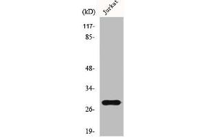 Western Blot analysis of Jurkat cells using GSTT1/4 Polyclonal Antibody (GSTT1 Antikörper  (N-Term))