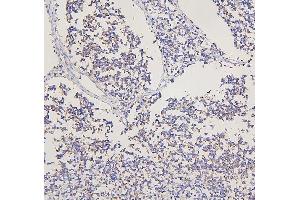 IHC analysis of GRM2 using anti-GRM2 antibody (ABIN7601733).