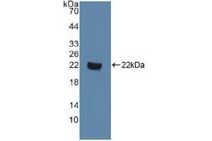 Western blot analysis of recombinant Human DVL1. (DVL1 Antikörper  (AA 150-285))