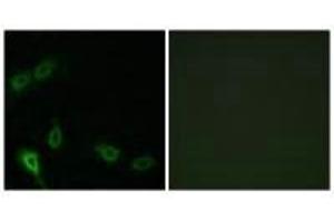 Immunofluorescence analysis of A549 cells, using MARK2 antibody. (MARK2 Antikörper  (N-Term))
