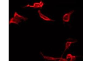 ABIN6266572 staining LOVO by IF/ICC. (Cytokeratin 19 Antikörper  (Internal Region))