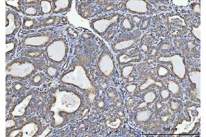 IHC analysis of GLDC using anti-GLDC antibody (ABIN7602072). (GLDC Antikörper  (AA 574-1020))