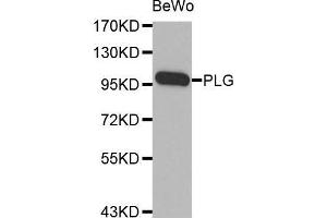 Western blot analysis of extracts of BeWo cell line, using PLG antibody. (PLG Antikörper  (AA 20-300))