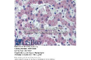 Immunohistochemistry (IHC) image for anti-Solute Carrier Family 27 (Fatty Acid Transporter), Member 2 (SLC27A2) (N-Term) antibody (ABIN2781594) (SLC27A2 Antikörper  (N-Term))