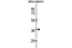 Western Blotting (WB) image for anti-Homeobox C10 (HOXC10) antibody (ABIN3001305) (HOXC10 Antikörper)