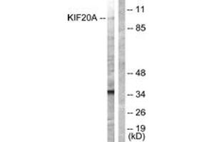 Western blot analysis of extracts from 293 cells, using KIF20A (Ab-528) Antibody.