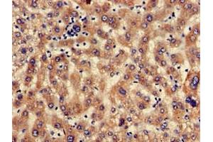 Immunohistochemistry of paraffin-embedded human liver tissue using ABIN7168659 at dilution of 1:100 (SEC23IP Antikörper  (AA 779-989))