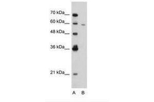 Image no. 3 for anti-Receptor-Interacting serine-threonine Kinase 3 (RIPK3) (AA 168-217) antibody (ABIN203367) (RIPK3 Antikörper  (AA 168-217))
