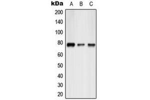 Western blot analysis of ATF6B expression in HepG2 (A), mouse liver (B), rat liver (C) whole cell lysates. (ATF6B Antikörper  (Center))