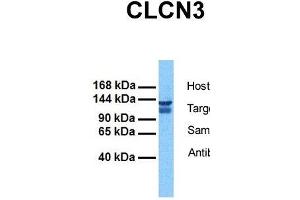 Western Blotting (WB) image for anti-Chloride Channel 3 (CLCN3) (C-Term) antibody (ABIN2776327)