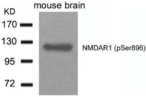Western blot analysis of extracts from Mouse Brain tissue using NMDAR1(Phospho-Ser896) Antibody. (GRIN1/NMDAR1 Antikörper  (pSer896))