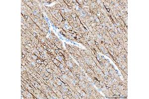 IHC analysis of Alpha Internexin using anti-Alpha Internexin antibody (ABIN4886634). (INA Antikörper  (AA 71-161))