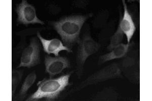 Immunofluorescent staining of HeLa (ATCC CCL-2) cells. (Cyclin B1 Antikörper)