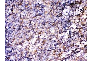 IHC testing of FFPE mouse lymph node with BCAR3 antibody. (BCAR3 Antikörper)