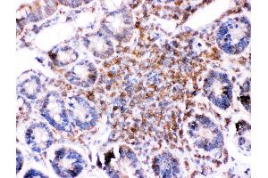 Immunohistochemistry (IHC) image for anti-BH3 Interacting Domain Death Agonist (BID) (AA 1-195) antibody (ABIN3042321)