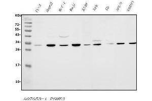 Western blot analysis of PSME2 using anti-PSME2 antibody (ABIN7599137).