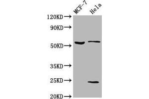 Western Blot Positive WB detected in: MCF-7 whole cell lysate, Hela whole cell lysate All lanes: SLC45A2 antibody at 5. (SLC45A2 Antikörper  (AA 1-46))
