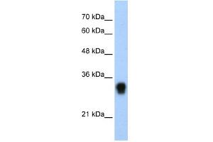 WB Suggested Anti-RPL8 Antibody Titration:  0. (RPL8 Antikörper  (C-Term))