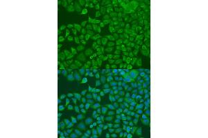 Immunofluorescence analysis of U2OS cells using FXR2 antibody (ABIN1872752) at dilution of 1:100. (FXR2 Antikörper)