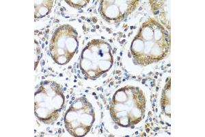 Immunohistochemistry of paraffin-embedded human colon using IFI44 antibody (ABIN6135120, ABIN6142168, ABIN6142169 and ABIN6224213) at dilution of 1:100 (40x lens). (IFI44 Antikörper)