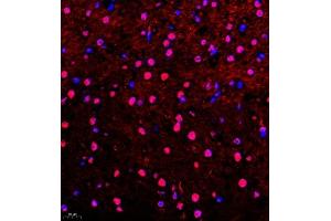Immunofluorescence of paraffin embedded mouse brain using Api5 (ABIN7073094) at dilution of 1:400 (400x lens) (Apoptosis Inhibitor 5 Antikörper)