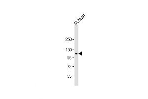Western Blotting (WB) image for anti-Natriuretic Peptide Receptor B/guanylate Cyclase B (Atrionatriuretic Peptide Receptor B) (NPR2) (AA 480-509) antibody (ABIN5536938)