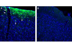 Expression of HCAR1 in mouse parietal cortex. (G Protein-Coupled Receptor 81 (GPR81) Peptid)