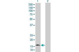 Western Blotting (WB) image for G0S2 293T Cell Transient Overexpression Lysate(Denatured) (ABIN1336198)