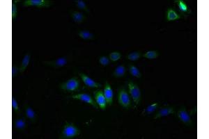 Immunofluorescent analysis of HepG2 cells using ABIN7175622 at dilution of 1:100 and Alexa Fluor 488-congugated AffiniPure Goat Anti-Rabbit IgG(H+L) (LRRC8E Antikörper  (AA 353-630))