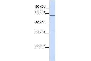 WB Suggested Anti-PPP2R3B Antibody Titration:  0.
