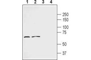 Western blot analysis of human MDA-231 breast carcinoma cell line lysate (lanes 1 and 3) and human THP-1 acute monocytic leukemia cell line lysate (lanes 2 and 4): - 1,2. (FZD2 Antikörper  (Extracellular))