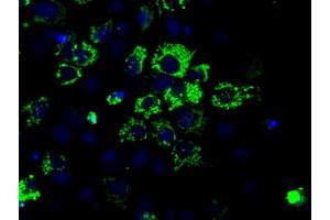 Anti-ACO2 mouse monoclonal antibody (ABIN2452695) immunofluorescent staining of COS7 cells transiently transfected by pCMV6-ENTRY ACO2 (RC204307). (ACO2 Antikörper)