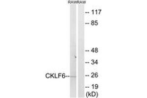 Western blot analysis of extracts from RAW264. (CKLF Antikörper  (AA 131-180))