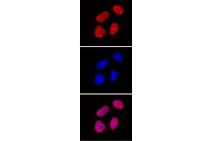 Histone H3 di/trimethyl Lys27 antibody (mAb) tested by immunofluorescence.