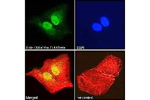 ABIN185294 Immunofluorescence analysis of paraformaldehyde fixed A549 cells, permeabilized with 0.