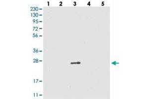 Western blot analysis of Lane 1: RT-4, Lane 2: U-251 MG, Lane 3: Human Plasma, Lane 4: Liver, Lane 5: Tonsil with VSTM2A polyclonal antibody . (VSTM2A Antikörper)