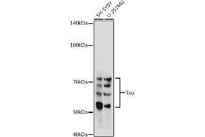 Western blot analysis of extracts of various cell lines, using Tau antibody (ABIN3021441, ABIN3021442, ABIN3021443 and ABIN6215045) at 1:500 dilution. (MAPT Antikörper  (AA 1-100))