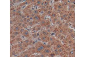 Used in DAB staining on fromalin fixed paraffin- embedded Kidney tissue (MMP21 Antikörper  (AA 335-547))