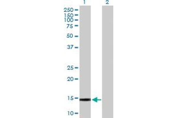 Galnt1 Antikörper  (AA 1-105)