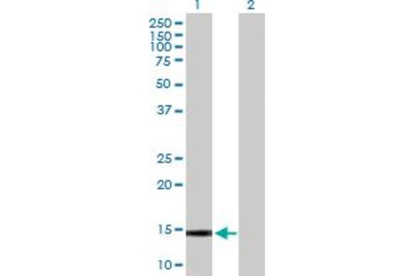 Galnt1 anticorps  (AA 1-105)