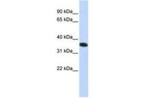 Image no. 1 for anti-Chromosome 21 Open Reading Frame 59 (C21orf59) (N-Term) antibody (ABIN6740941) (C21orf59 Antikörper  (N-Term))