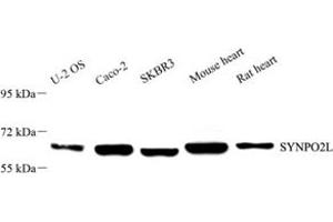 Western blot analysis of SYNPO2L (ABIN7075791) at dilution of 1: 2000