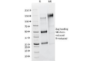 SDS-PAGE Analysis Purified FSH Receptor Mouse Monoclonal Antibody (FSHR/1400). (FSHR Antikörper)